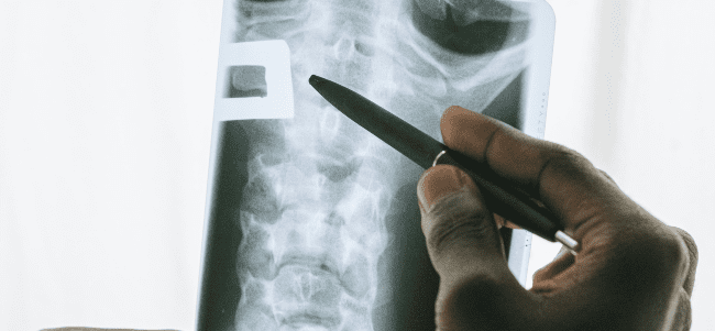 sacroiliac joint injection PLACE