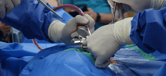 doctor conducting spinal surgery